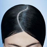treatment-1